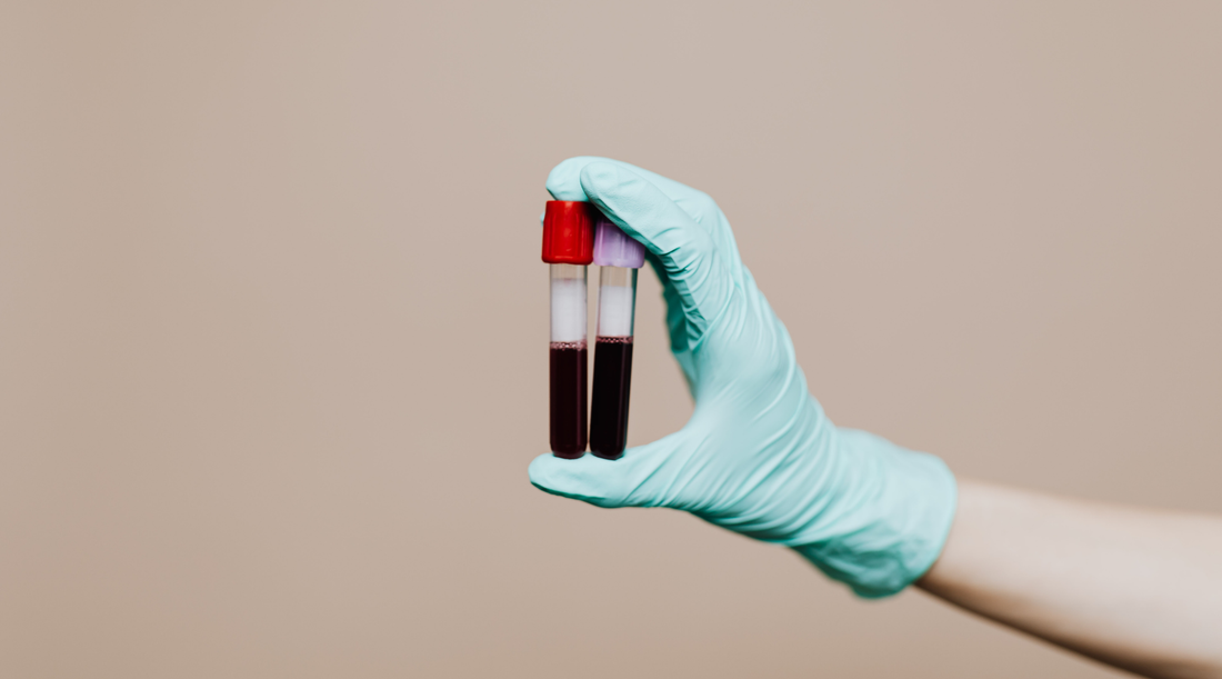The 5 Tests I Run Most with My Nutrition Patients